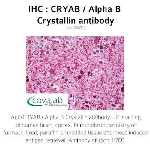 CRYAB / Alpha B Crystallin antibody