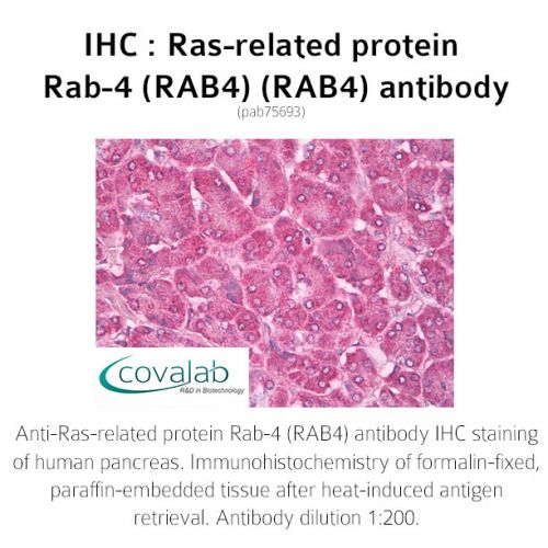 Ras-related protein Rab-4 (RAB4) (RAB4) antibody