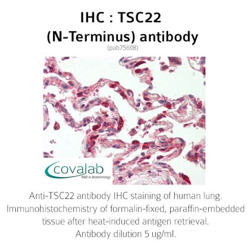 TSC22 (N-Terminus) antibody