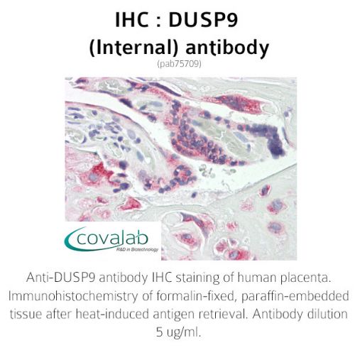 DUSP9 (Internal) antibody