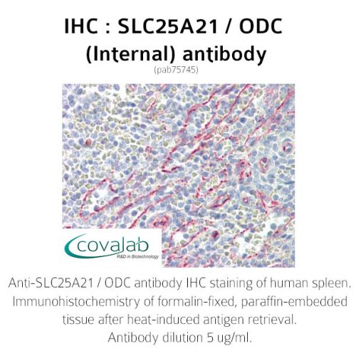 SLC25A21 / ODC (Internal) antibody