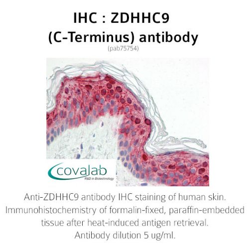 ZDHHC9 (C-Terminus) antibody