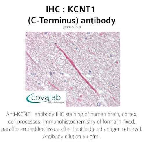 KCNT1 (C-Terminus) antibody