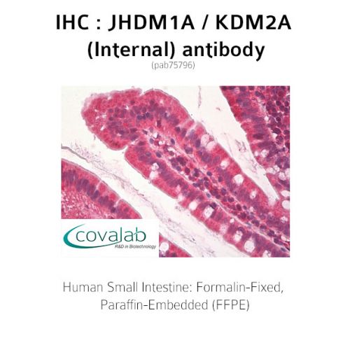 JHDM1A / KDM2A (Internal) antibody