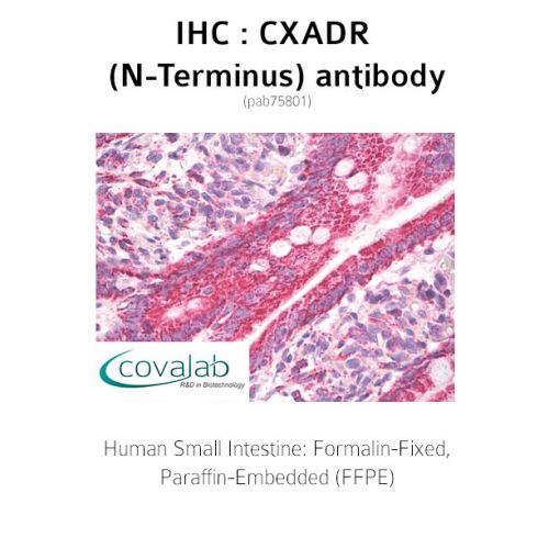 CXADR (N-Terminus) antibody