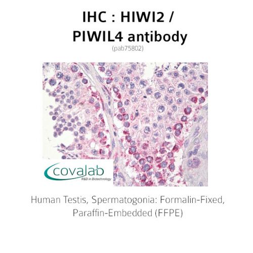 HIWI2 / PIWIL4 antibody