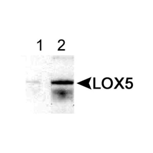 5-lipoxygenase antibody