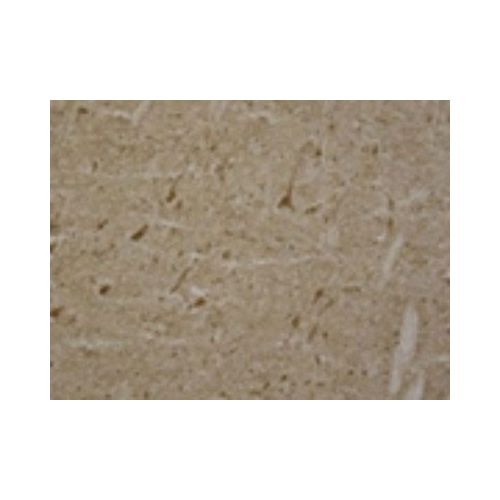 LRRK2 antibody