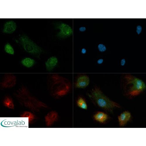 Robo4 antibody