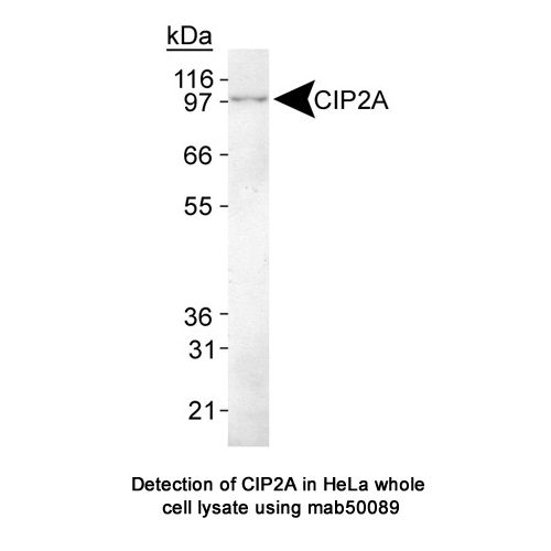 CIP2A antibody (2G10)