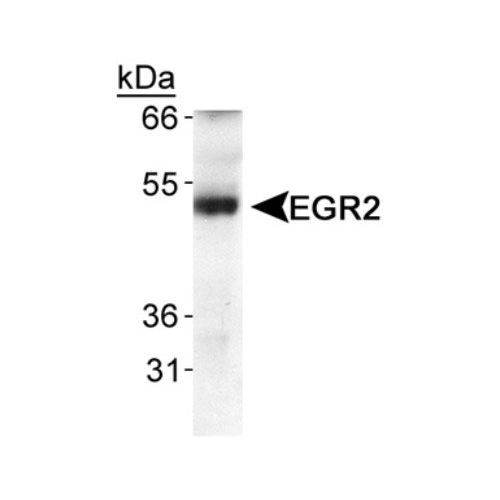 E3 SUMO-protein ligase EGR2 antibody
