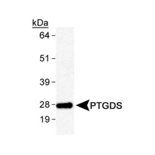 Prostaglandin D Synthase (Lipocalin) antibody