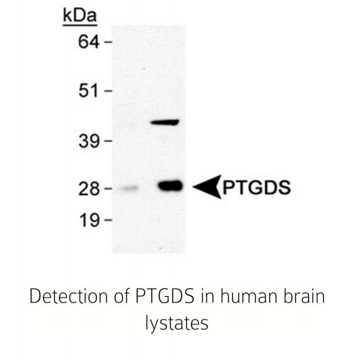 Prostaglandin D Synthase (Lipocalin) antibody