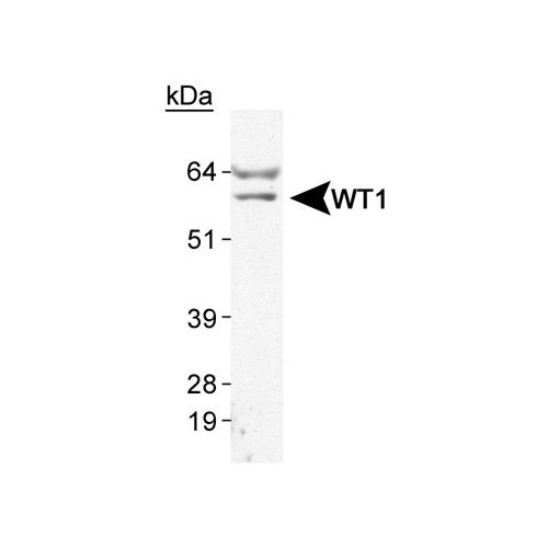 Wilms Tumor 1 antibody (6F-H2)