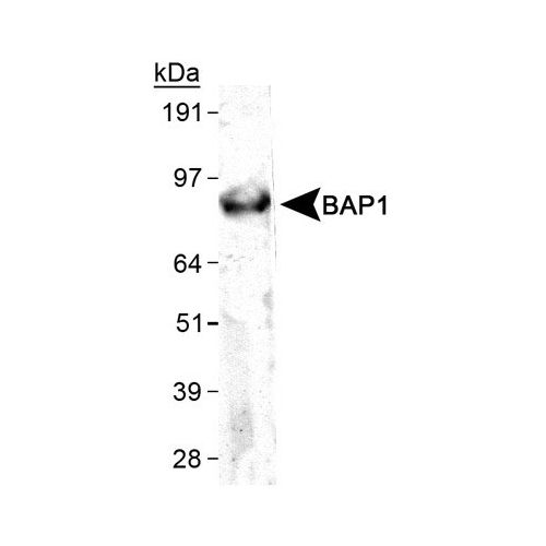 Ubiquitin carboxyl-terminal hydrolase BAP1 antibody