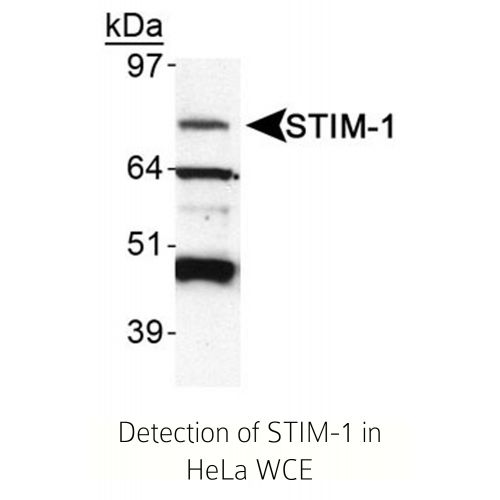 Stromal interaction molecule 1 antibody