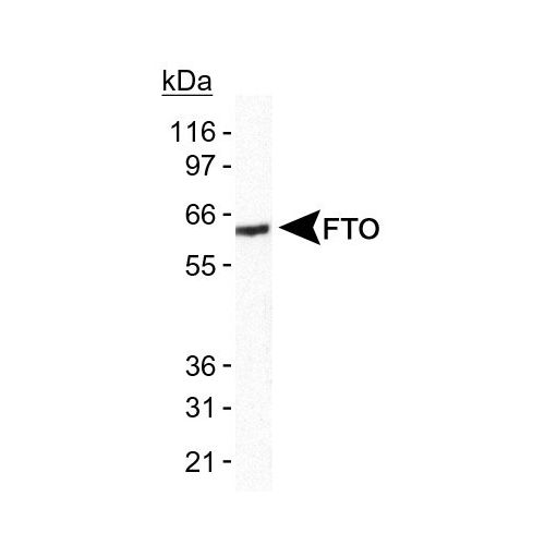 FTO antibody