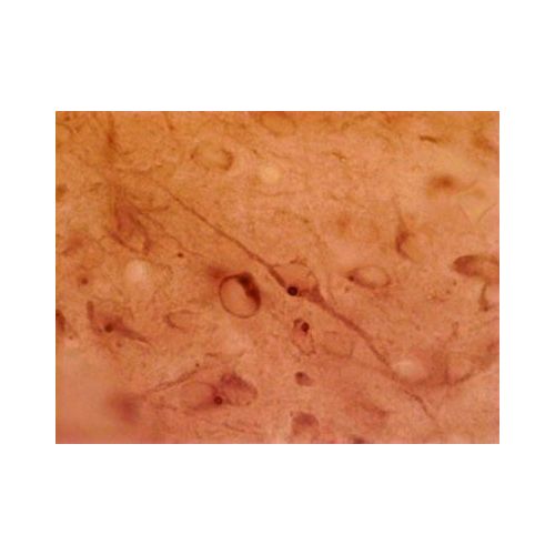 Huntingtin-associated protein 1 (HAP1) antibody