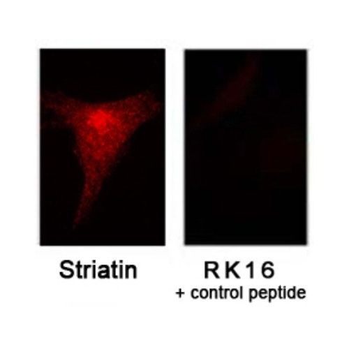 Striatin antibody