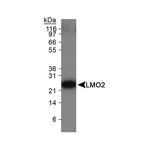 LMO2 antibody (1A9-3B11)