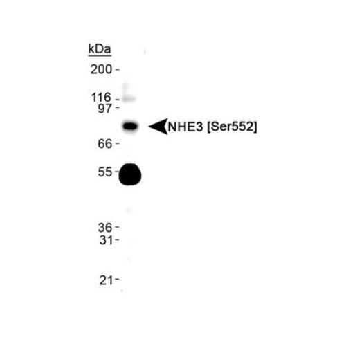 NHE3 [p Ser552] antibody (14D5)