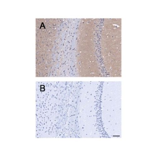Brain-specific angiogenesis inhibitor 1 antibody