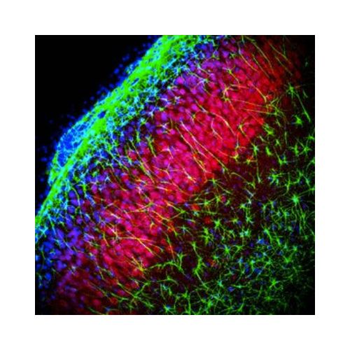 TRPM2 antibody