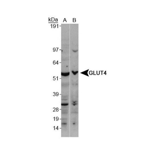 Glucose Transporter GLUT4 antibody