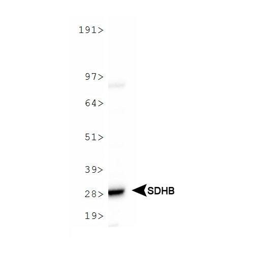 SDHB antibody