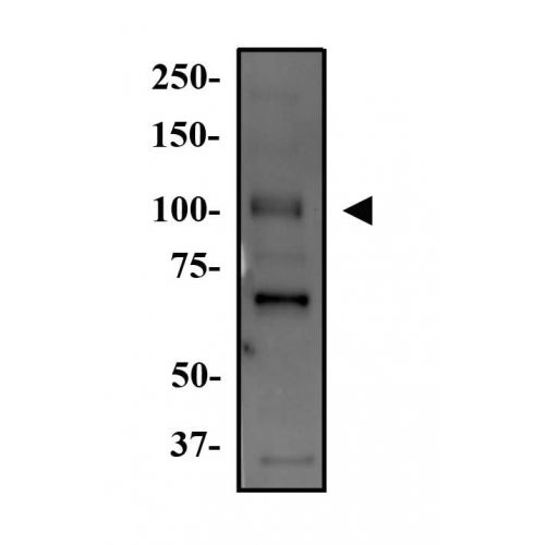 WNK4 antibody