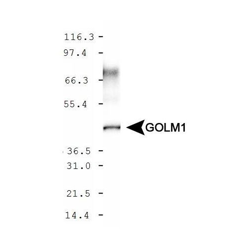 GOLM1 antibody