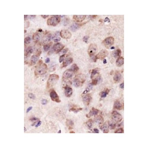 PINK1 antibody