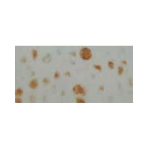 Neurofibromin 1 antibody