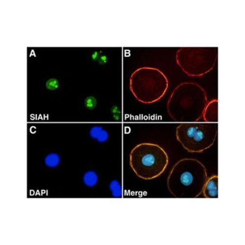 E3 ubiquitin-protein ligase SIAH2 antibody