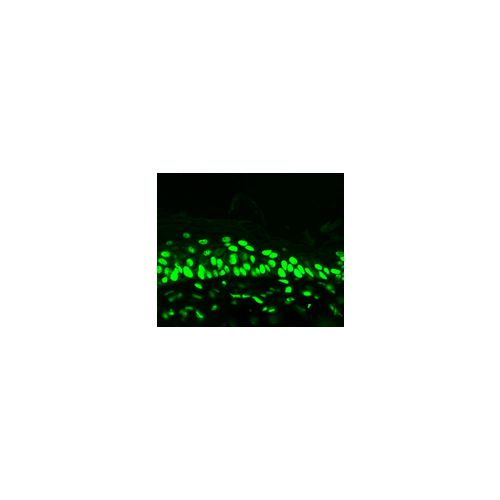 Acetylated Lysine (7F8) antibody