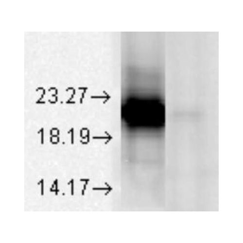 Alpha A Crystallin (1H3.B8) antibody