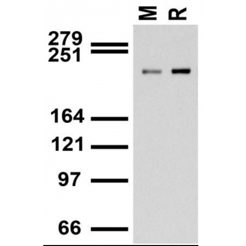 Ankyrin-B (S105-13) antibody