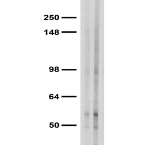Beta 1 GABA-A Receptor (S96-55) antibody