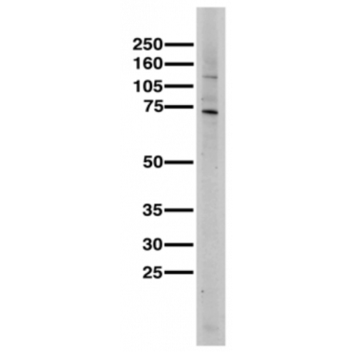 Cavβ2 Ca+2 Channel (S8b-1) antibody