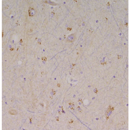 Chloride Channel Protein 3 (Clcn3) (S258-5) antibody