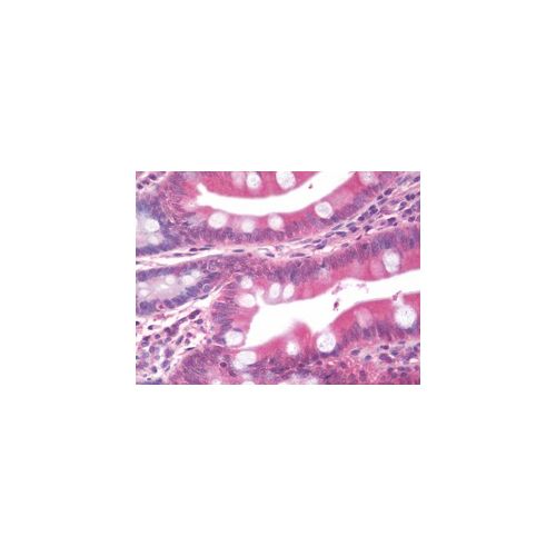 Copper-Transporting ATPase2 (S62-29) antibody