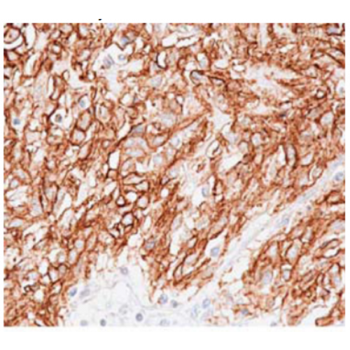 DOG1 (DOG1.1) antibody