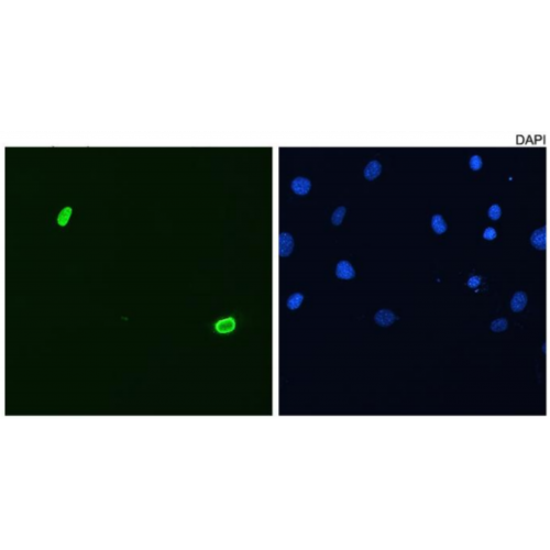 DUX4 (P2B1) antibody