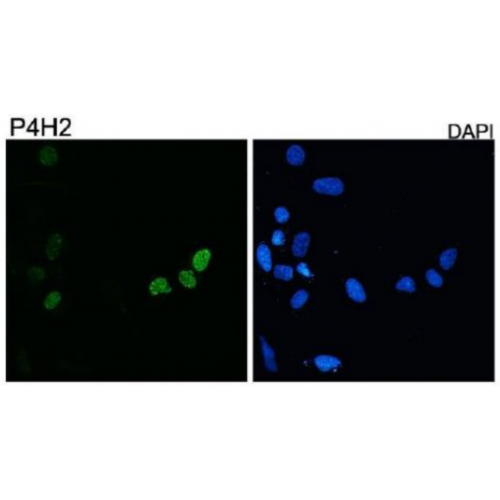 DUX4 (P4H2) antibody