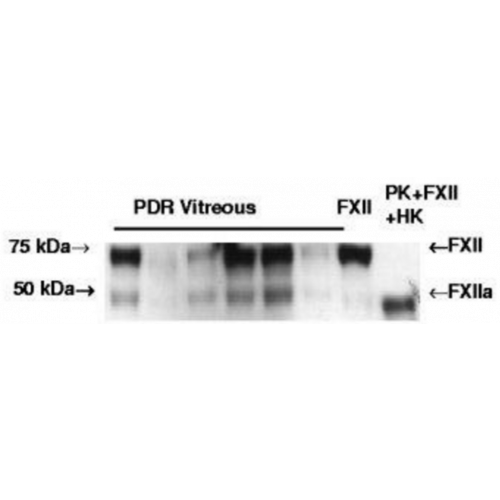 Factor XII Heavy Chain (B7C9) antibody