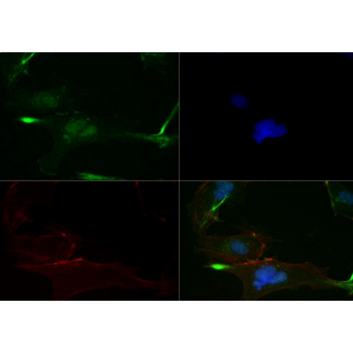 FGFR1 antibody (M17D10)