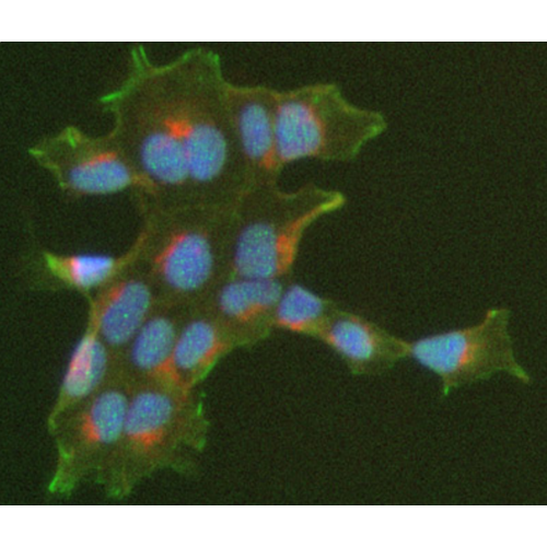 Fibroblast Growth Factor Receptor 1 (FGFR1) (M19B2) antibody