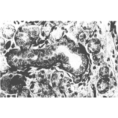 Fibroblast Growth Factor Receptor 1 (FGFR1) (M5G10) antibody