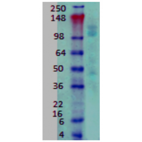 GABA(B)R1 (S93A-49) antibody