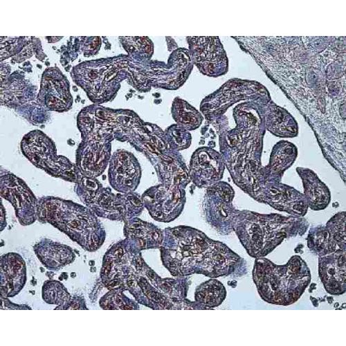 HIF1 alpha (ESEE122) antibody